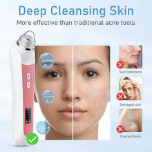 Load image into Gallery viewer, Stainless Steel Blackhead Vacuum with USB &amp; 3 Modes - Ideal for All Skin Types