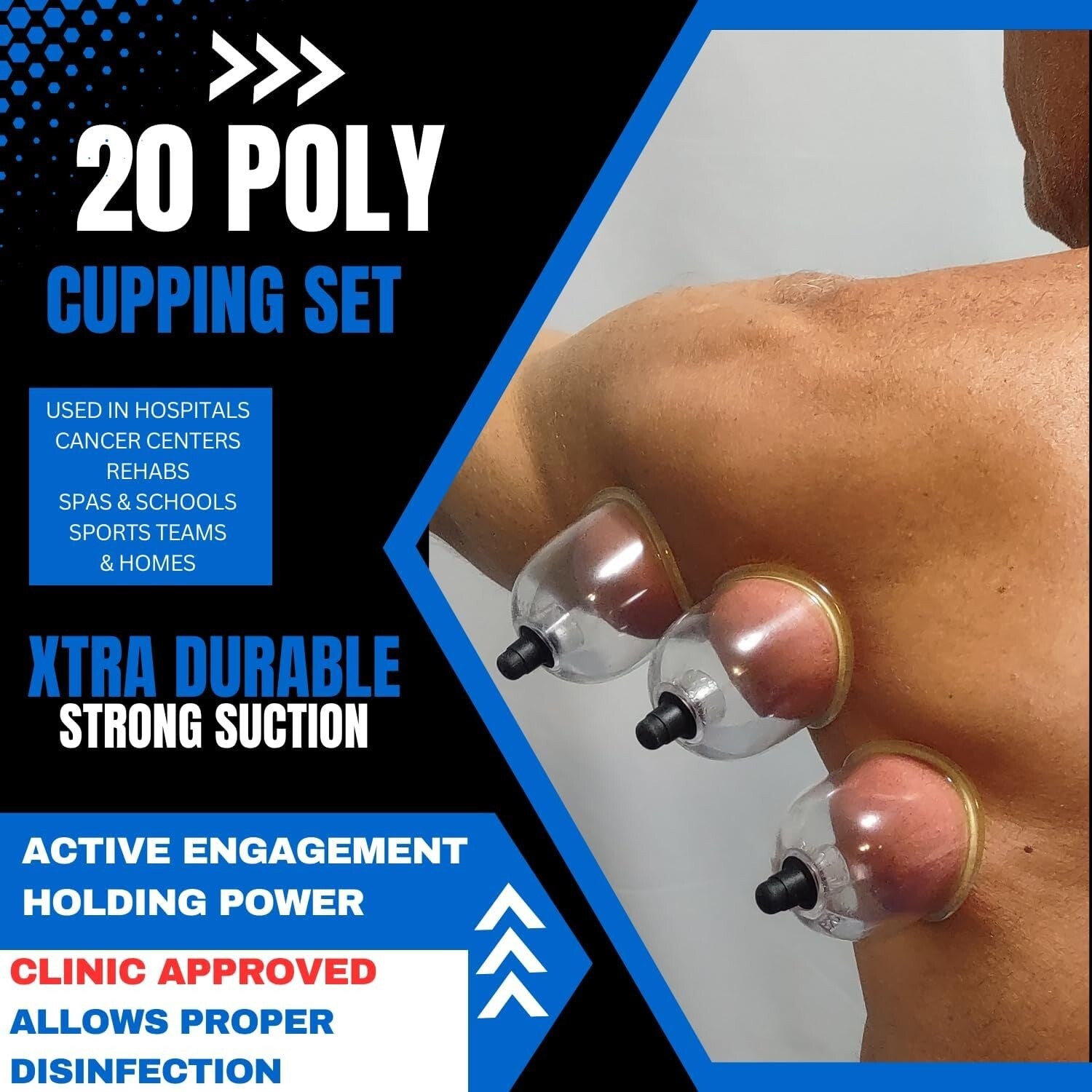 Professional 20-Cup Cupping Set - Durable Poly Pump Cups for Myofascial Relief