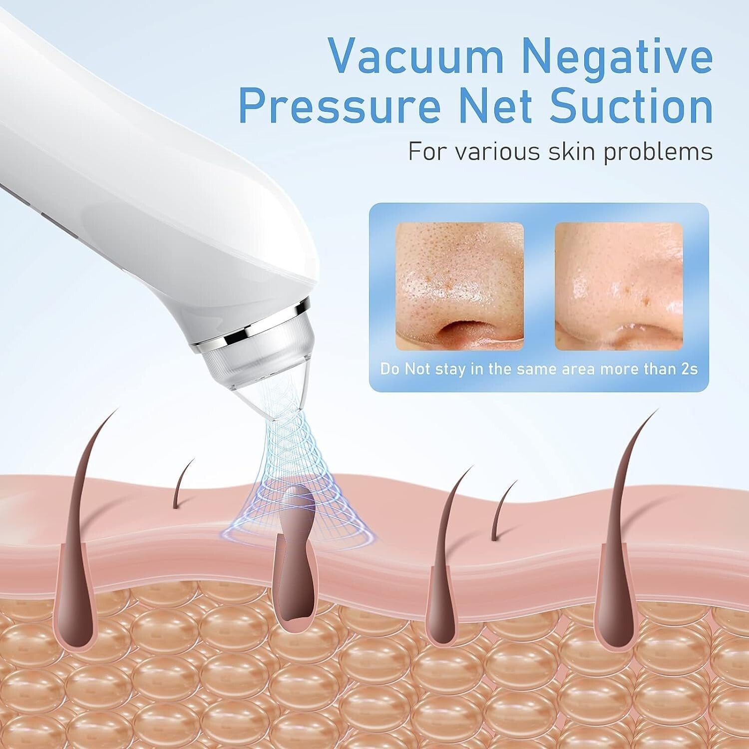Advanced Pore Vacuum with Integrated Camera - Portable Blackhead Removal Tool