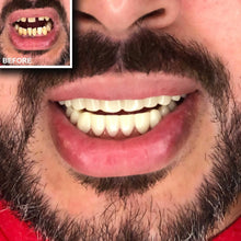 Load image into Gallery viewer, Natural Shade Comfort Fit Flex Teeth Veneer Set - Quick Smile Transformation
