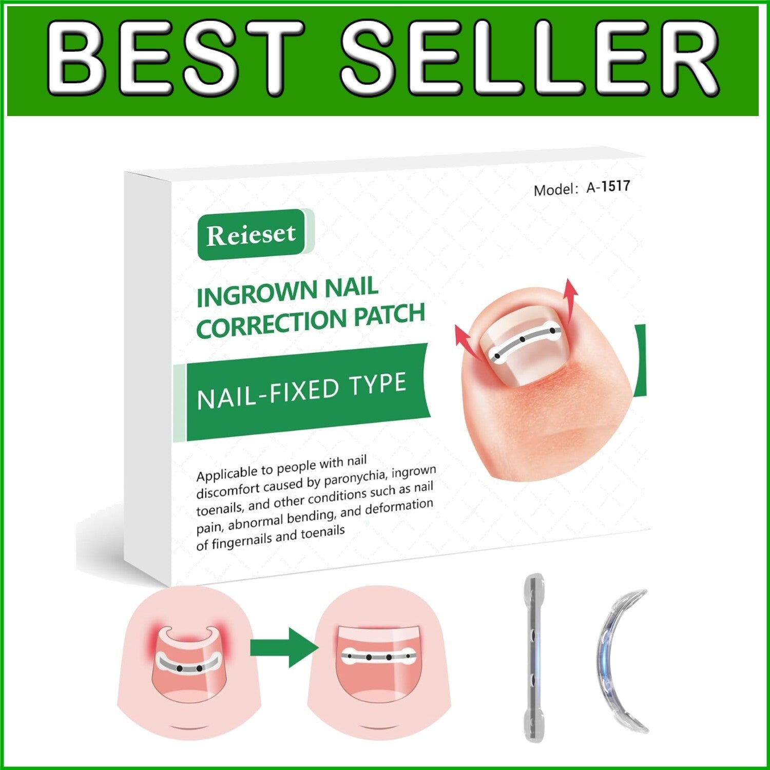 Advanced Ingrown Toenail Treatment Kit – Titanium Alloy Solution for All Nails