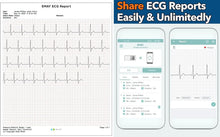 Load image into Gallery viewer, Rechargeable ECG Monitor: Lead I Heart Rate Recorder | Smartphone Compatible