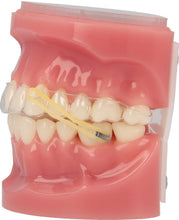 Load image into Gallery viewer, Top Quality 3/16" Gorilla Elastics in 100 Packs | 10,000 Total for Orthodontics