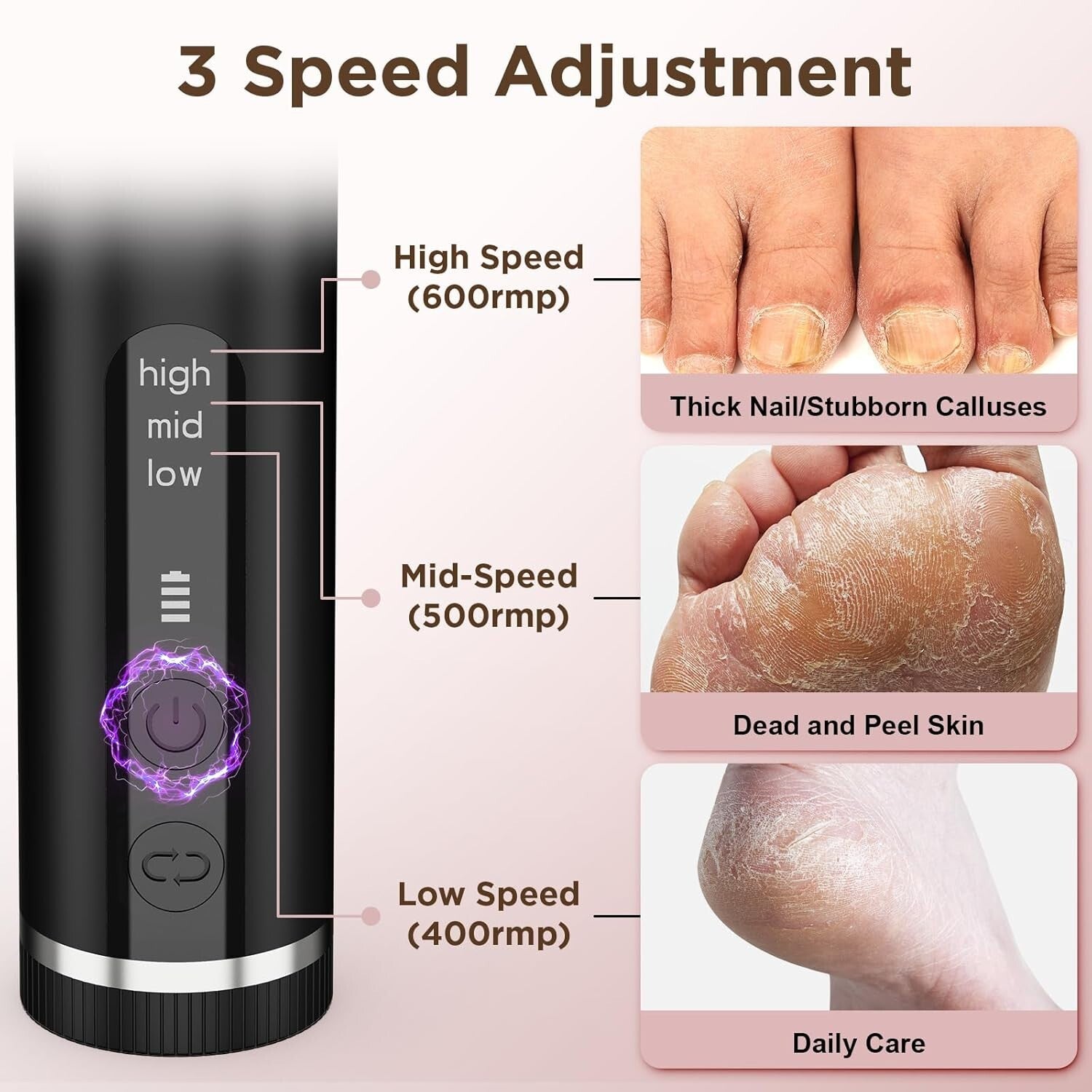 Nano-Glass Electric Foot Callus Remover - Cordless, Adjustable Speeds & 60 Discs