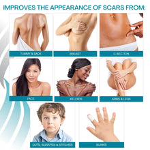 Load image into Gallery viewer, Medical Grade Silicone Scar Sheets - 4 Pack for Old &amp; New Scars, Burns, Keloids