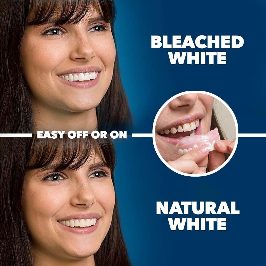 Premium BPA-Free Upper Veneers - Large Size for Effortless Smile Improvement