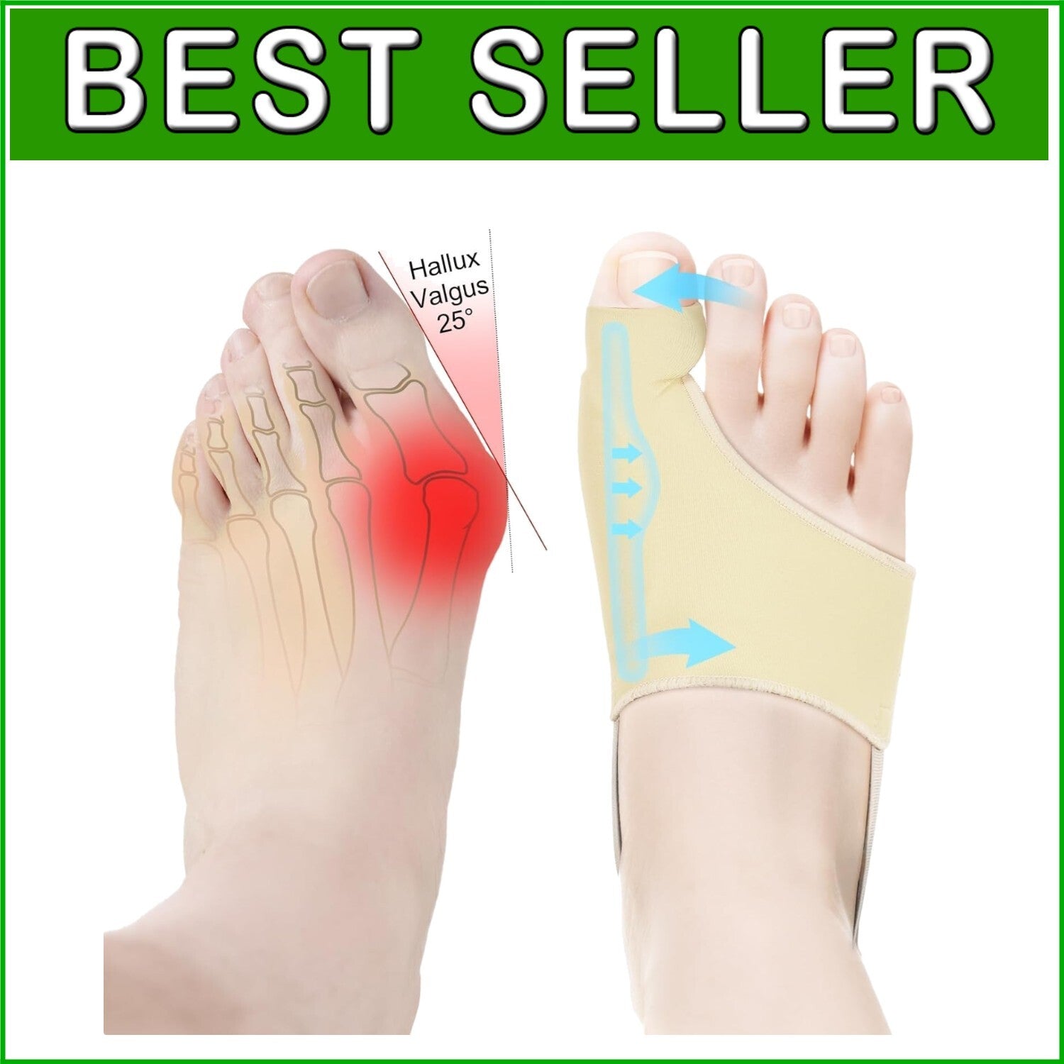 Breathable Bunion Splint for Men & Women - Effective Hallux Valgus Pain Relief