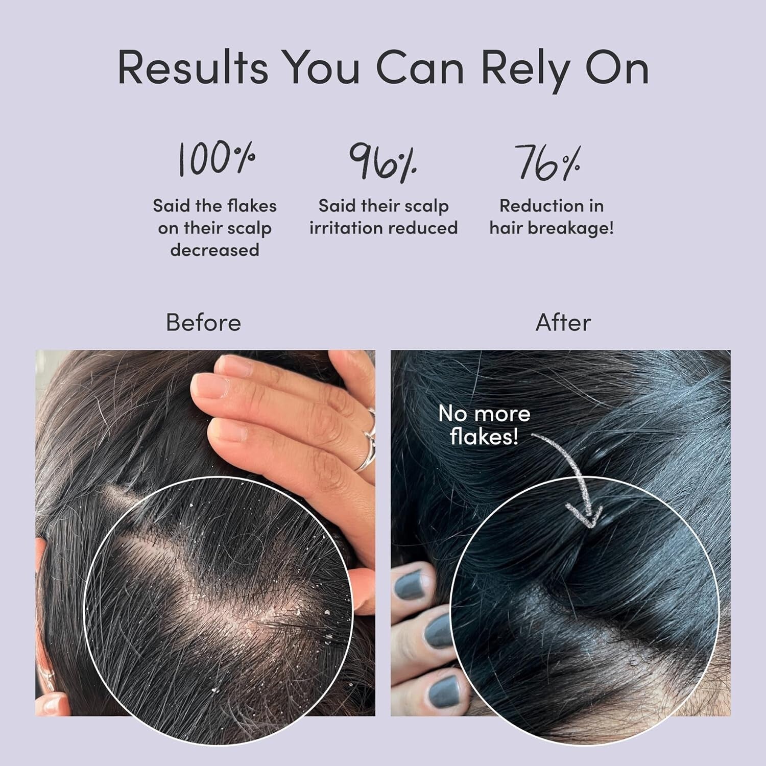 Soothing Anti-Dandruff Shampoo and Conditioner for Itchy, Flaky Scalp Relief