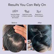 Load image into Gallery viewer, Soothing Anti-Dandruff Shampoo and Conditioner for Itchy, Flaky Scalp Relief