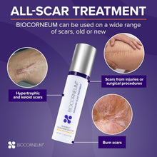 Load image into Gallery viewer, Surgeon-Recommended Silicone Scar Gel with SPF 30 - 10g Advanced Treatment
