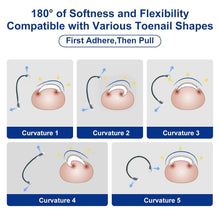 Load image into Gallery viewer, Nitinol Ingrown Toenail Corrector Kit - Fast Relief &amp; Shape Change in 30 Days