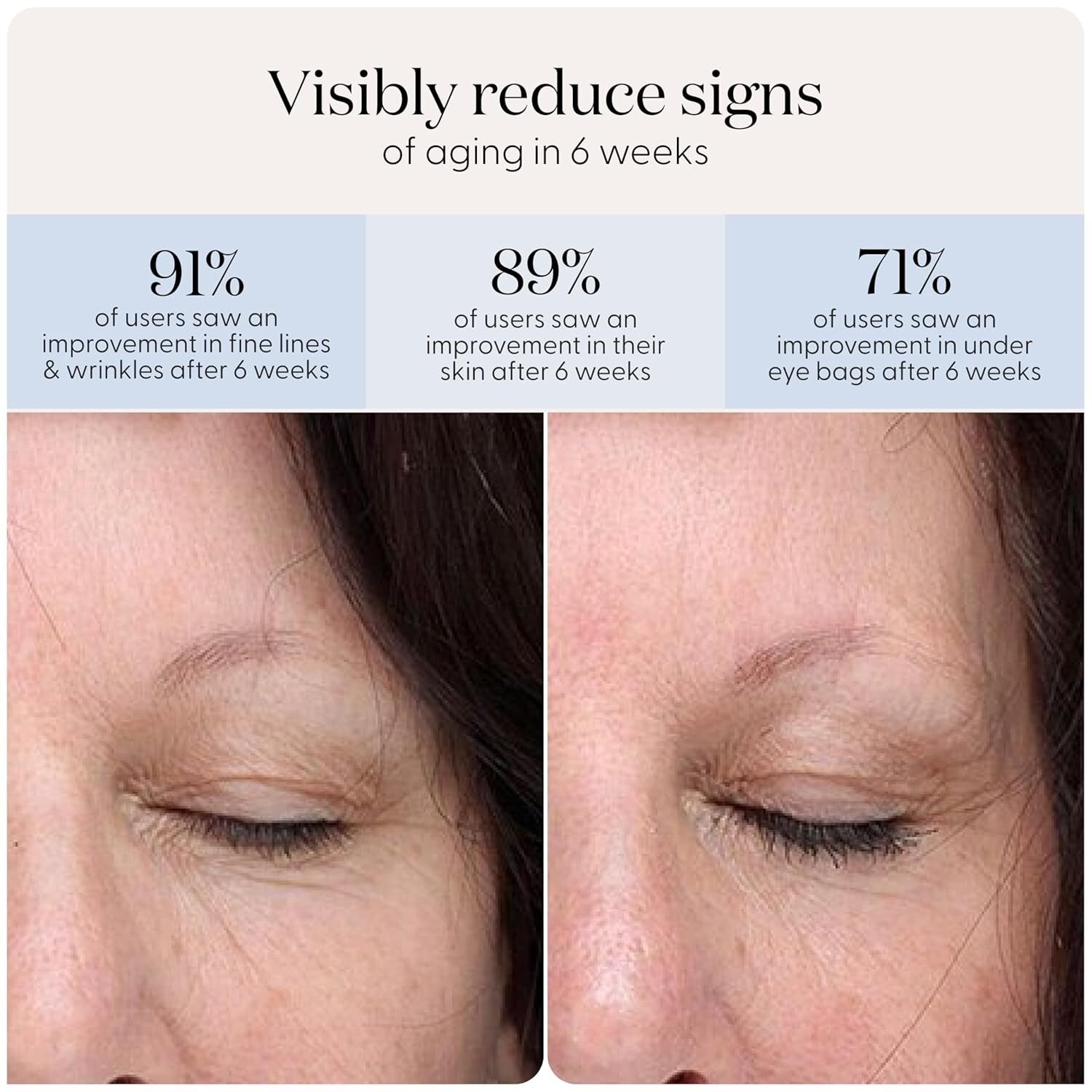 Compact LED Eye Patches with Hydrocolloids - Reduce Wrinkles & Brighten Skin