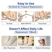 Load image into Gallery viewer, Nitinol Ingrown Toenail Corrector Kit - Fast Relief &amp; Shape Change in 30 Days
