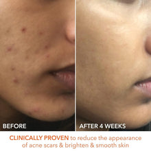 Load image into Gallery viewer, Dr. Dennis Gross Daily Peel: 60 Exfoliating Pads for Radiant Skin &amp; Anti-Aging