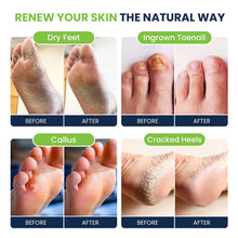 Load image into Gallery viewer, Revitalizing Epsom Salt &amp; Tea Tree Oil Foot Soak for Relaxation &amp; Fungal Support