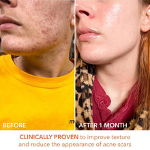 Load image into Gallery viewer, Dr. Dennis Gross Peel Pads - Fast-Acting 2-Step Treatment for Flawless Skin