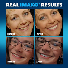 Load image into Gallery viewer, Natural White Cosmetic Teeth Veneers - 2 Pack Large Size for Easy Smile Makeover
