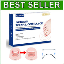 Load image into Gallery viewer, Nitinol Ingrown Toenail Corrector Kit - Fast Relief &amp; Shape Change in 30 Days