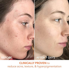 Load image into Gallery viewer, Dr. Dennis Gross Peel Pads - Fast-Acting 2-Step Treatment for Flawless Skin