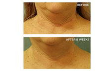 Load image into Gallery viewer, Travel-Friendly Cold Plasma SPF 25 Moisturizer for Neck &amp; Chest - 2 FL OZ