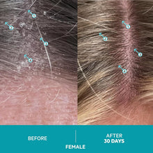Load image into Gallery viewer, Dandrene Anti-Dandruff Shampoo - Exfoliating Formula for Itchy Scalp Relief