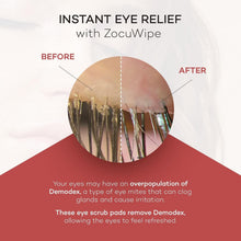 Load image into Gallery viewer, Moisturizing Eyelid Wipes for Blepharitis Relief - Natural and Travel-Friendly