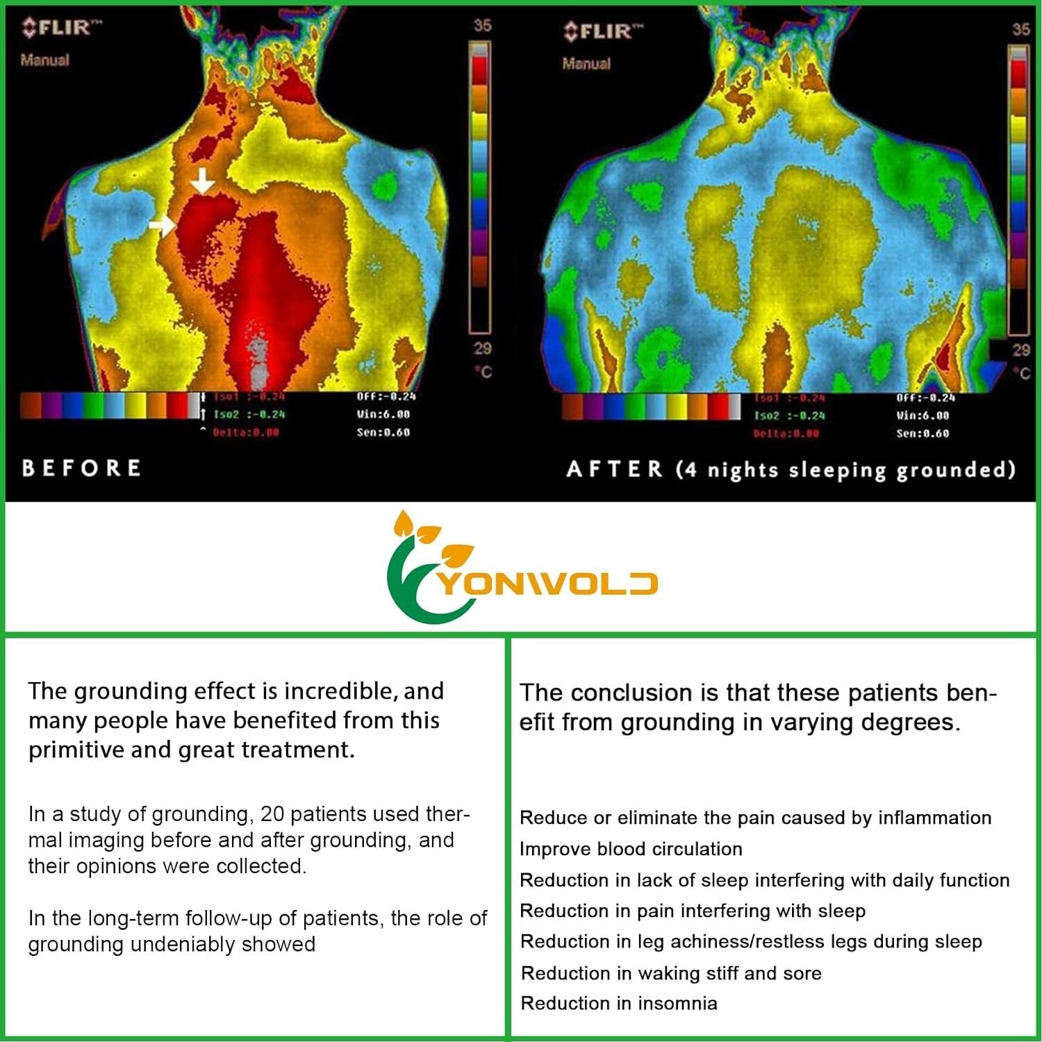 10% Silver King Size Sleep Therapy Sheet with Safe Grounding Adapter, 76x80 IN