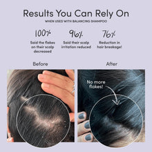 Load image into Gallery viewer, 3-in-1 Anti-Dandruff Solution: Shampoo, Nourishing Conditioner &amp; Scalp Massager