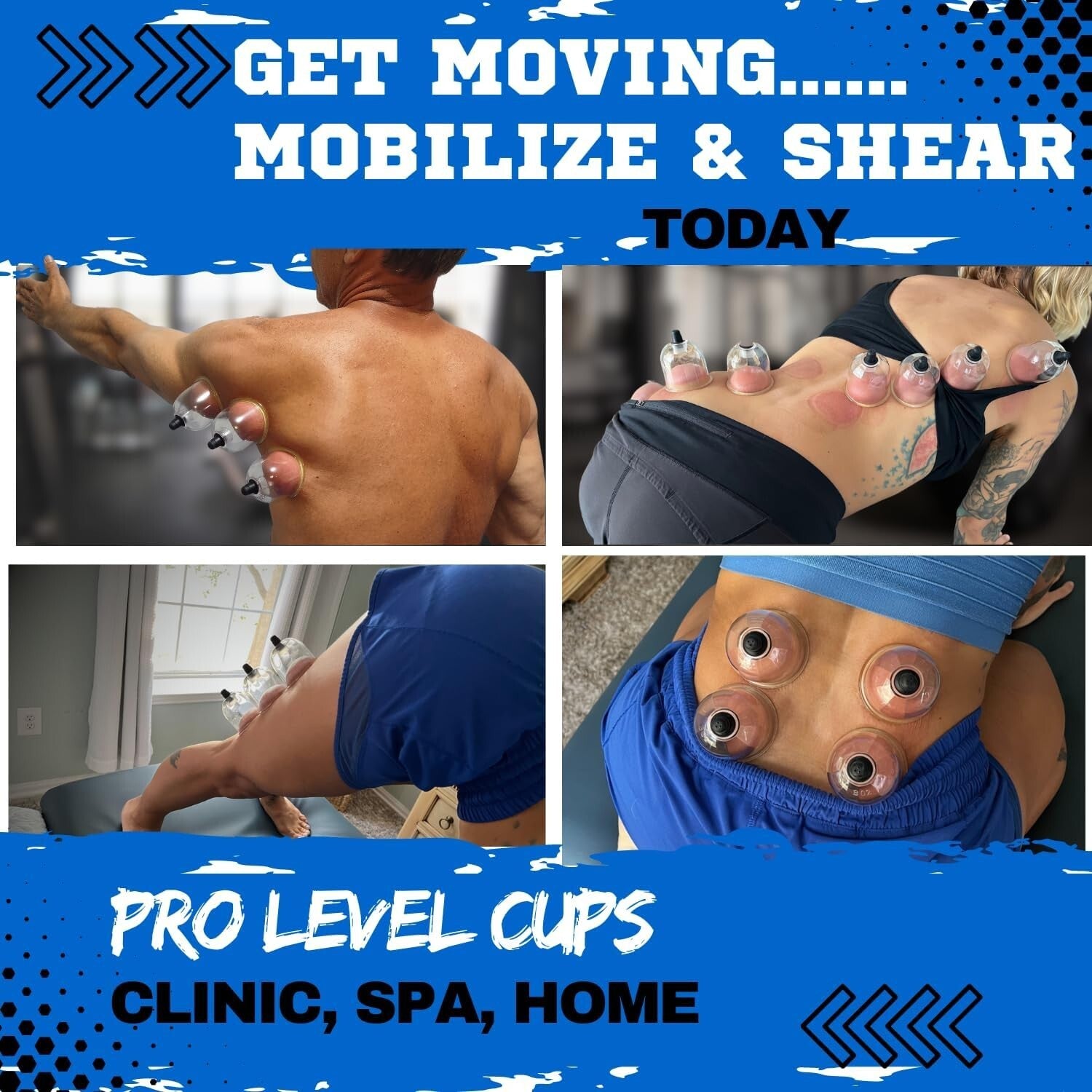 Professional 20-Cup Cupping Set - Durable Poly Pump Cups for Myofascial Relief