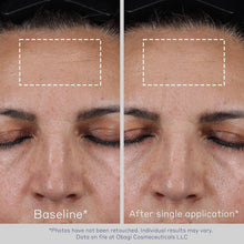 Load image into Gallery viewer, Obagi ELASTIderm Non-Injectable Filler 0.68 oz - Reduces Fine Lines Effortlessly
