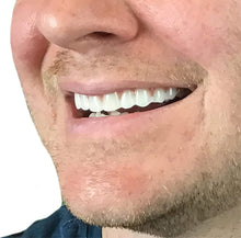 Load image into Gallery viewer, Re-moldable Ultra-thin Comfort Flex Veneers - Fix Your Smile in Minutes