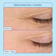 Load image into Gallery viewer, Refreshing Anti-Aging Eye Cream for Dark Circles &amp; Crow's Feet - 0.5 oz
