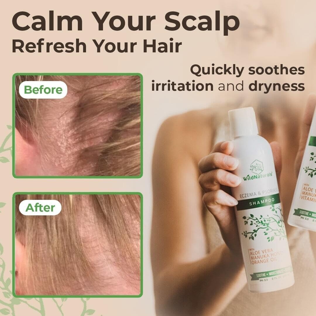Gentle Anti-Dandruff Shampoo for Eczema & Sensitive Scalps - Unscented Comfort