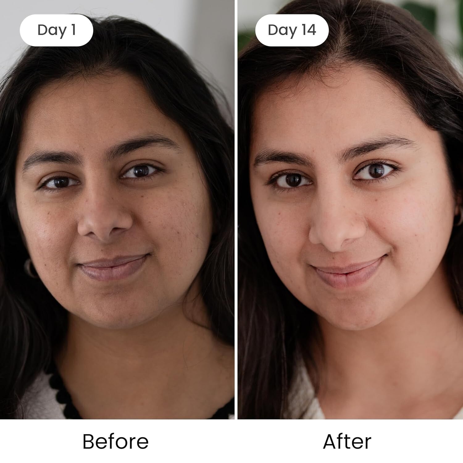 Timeless Kumkumadi Oil with Pure Saffron & Rose Aroma - 18ml Luxury Facial Oil