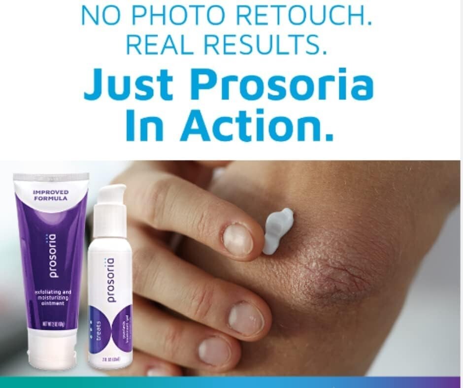 Dual Action Psoriasis Relief - 4 Bottles of Clinical Strength Exfoliating Care