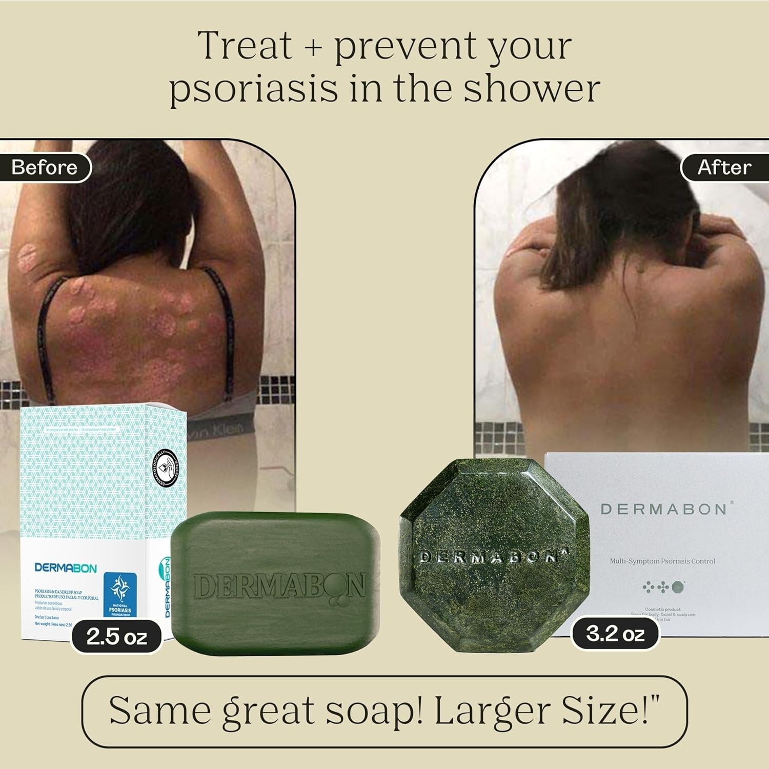 Hydrating 2% Coal Tar Eczema Soap Bar – Daily Relief for Sensitive Skin - 3 Pack