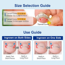 Load image into Gallery viewer, Nitinol Ingrown Toenail Corrector Kit - Fast Relief &amp; Shape Change in 30 Days
