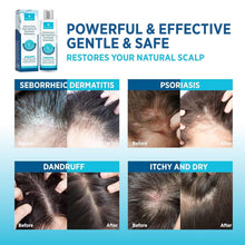 Load image into Gallery viewer, Seborrheic Dermatitis &amp; Psoriasis Relief Set – Complete Scalp Therapy Solution