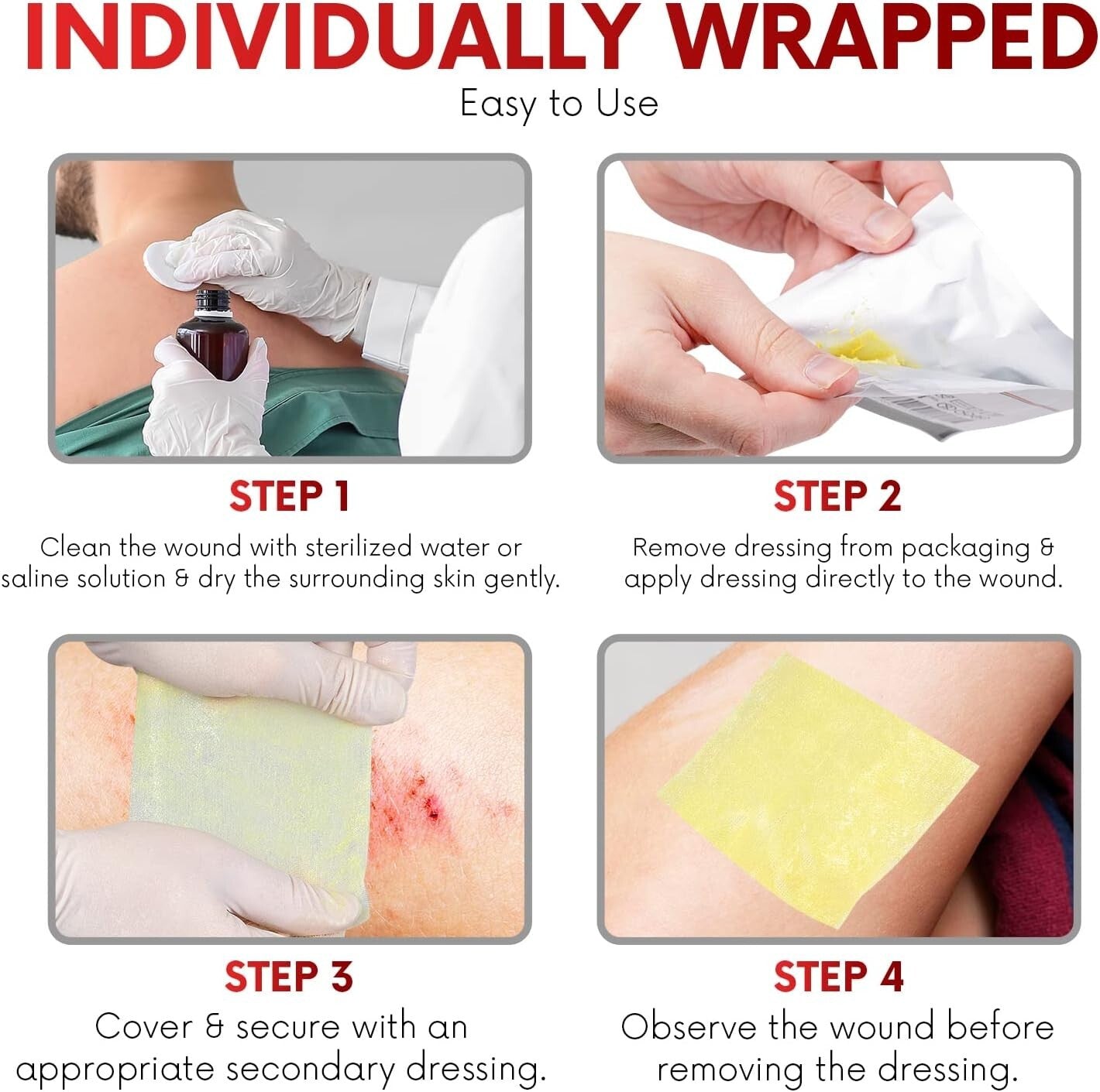 Xeroform Petrolatum Dressing 5x9 - Non-Adherent Sterile Wound Care Pads (50 ct)