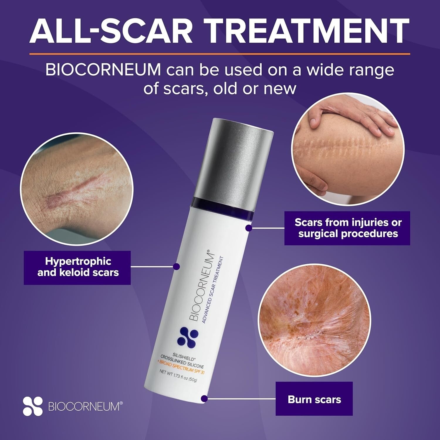 Advanced Silicone Scar Gel with Silishield & SPF 30 - Fast-Drying & Effective